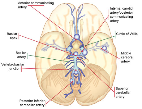 Anatomy of the Brain (posterior vs. anterior circulation, circle of Willis, basilar tip, etc.)
