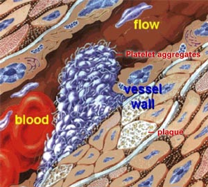 Thrombus Formation Muller, 1997